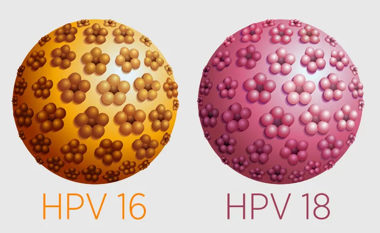 Hpv nedir tedavisi var m