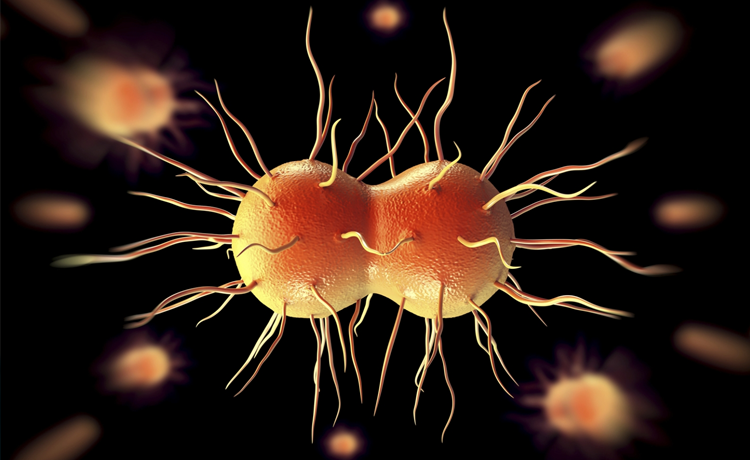 Bel Soğukluğu (Gonore) Nedir, Belirtileri Nelerdir?