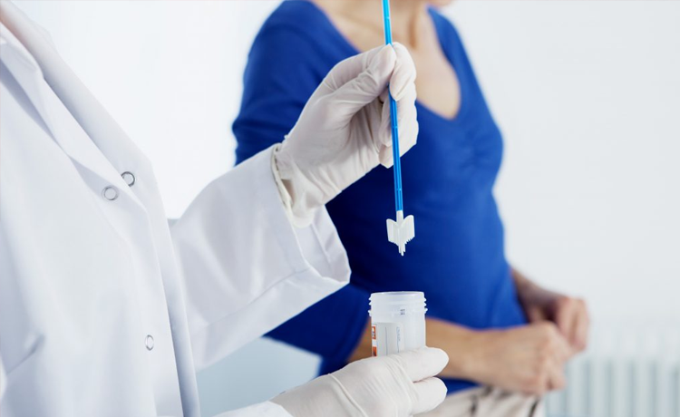 Genital Siğil Nasıl Tedavi Edilir?