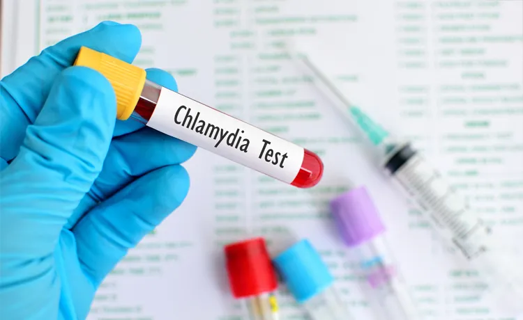 Klamidya Test Fiyatı Ne Kadar?