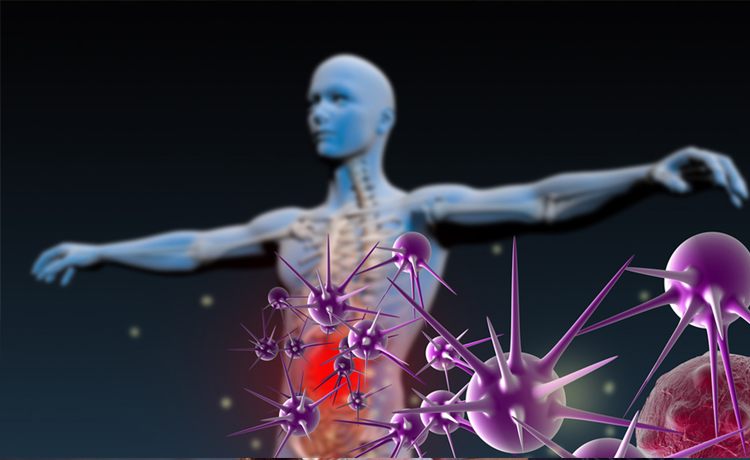 Anal Kanseri Hangi Sebeplerle Ortaya Çıkar?