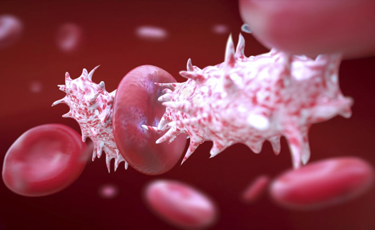 Vajina Kanserine HPV Sebep Olur mu?