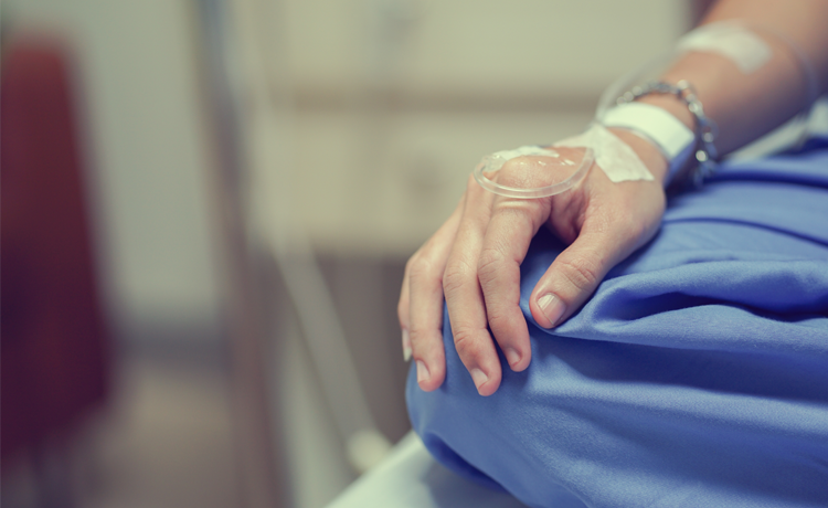 Anal Kanserinin Tedavi Yöntemleri Nelerdir?