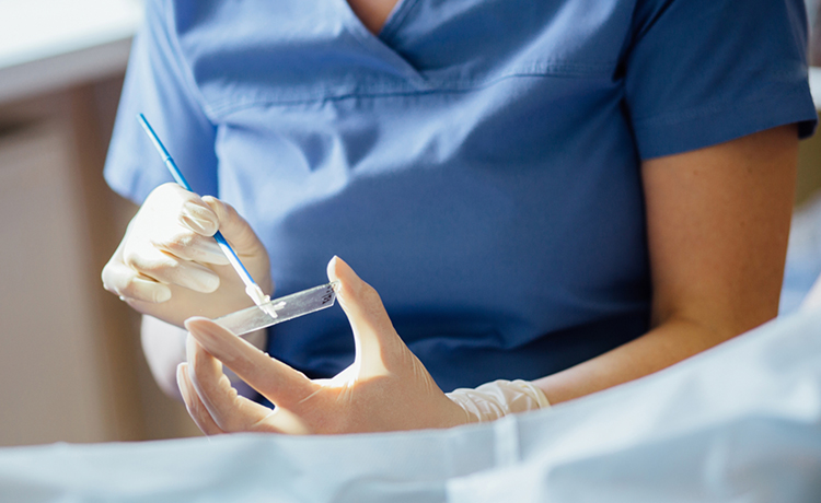 Smear Testi Sonuçları Neden Geç Çıkar?