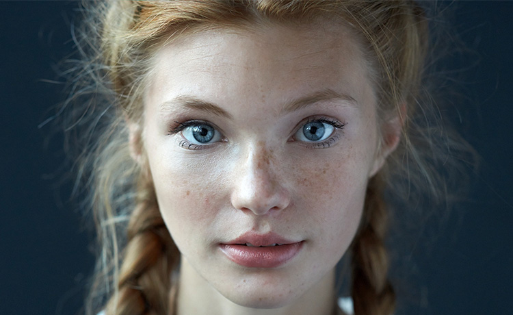 Cilt Kanseri Risk Faktörleri Nelerdir?