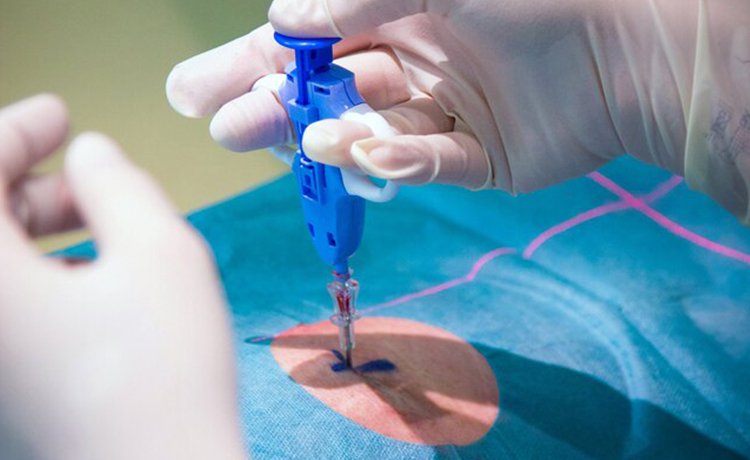 CIN’e Karşı Uygulanan Tedavi Yöntemleri Nelerdir?