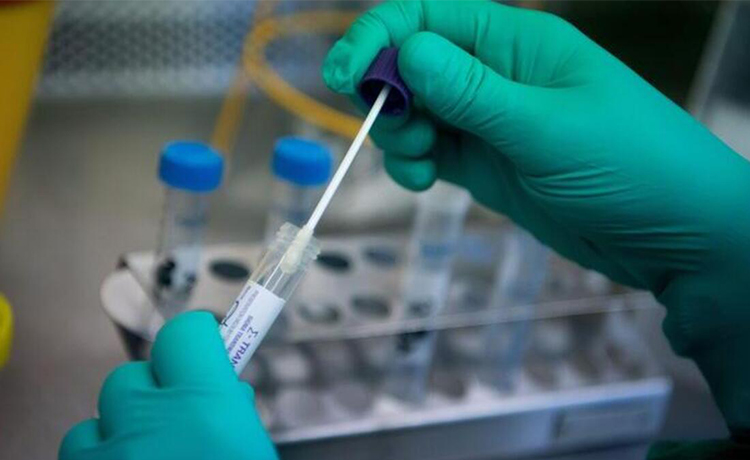 HPV DNA Testi Nasıl Uygulanır?