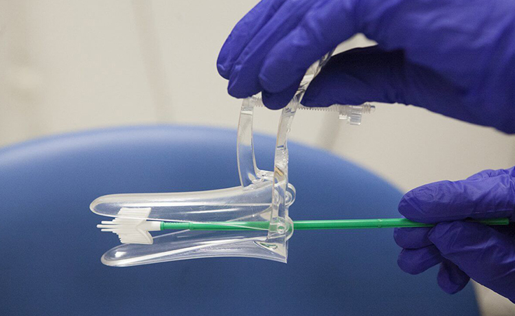 Makat Siğillerinde Tanı Testleri Nelerdir?